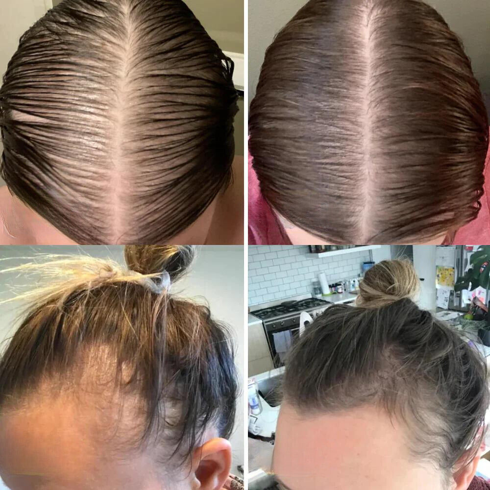 RevitaCrown | Ignite Your Scalp’s Power for Thick, Head-Turning Hair | ribuella