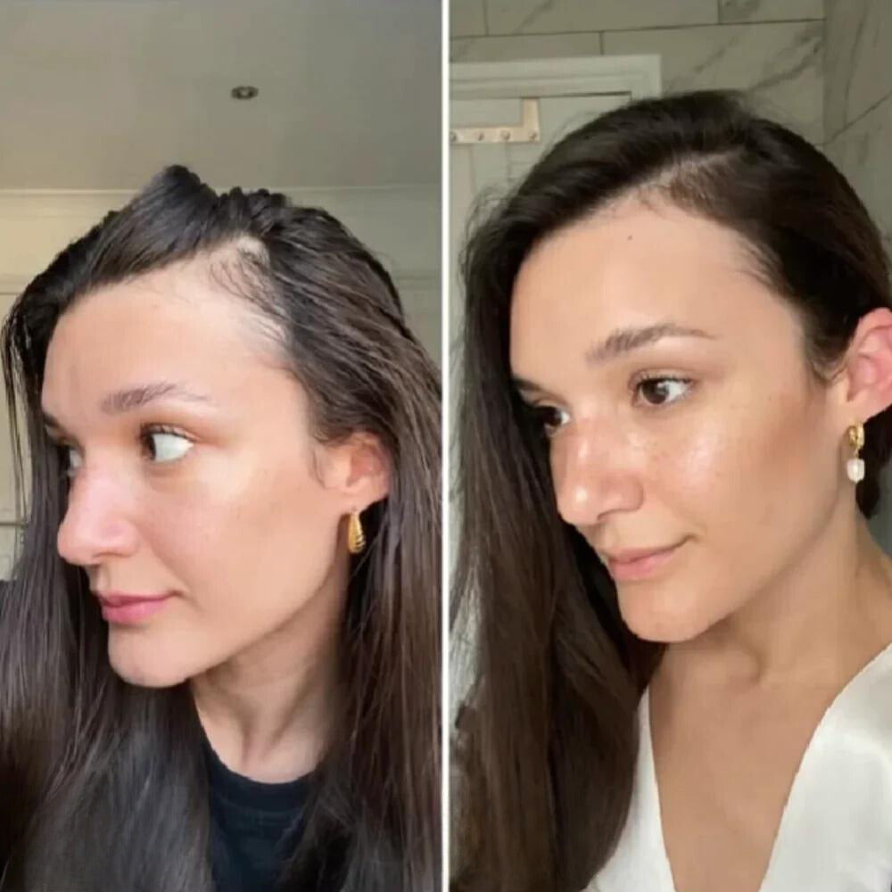 RevitaSilk | Unlock Lush, Thick Hair That Commands Attention and Confidence | ribuella