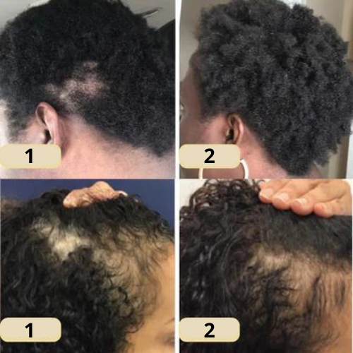 RevitaCrown | Ignite Your Scalp’s Power for Thick, Head-Turning Hair | ribuella