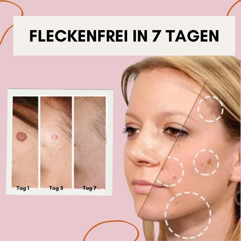 Säg adjö till hudimperfektioner med Flawless Fade | ribuella