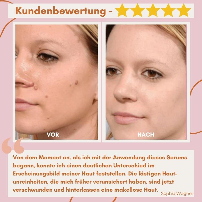 Say Goodbye to Skin Imperfections with Flawless Fade | ribuella