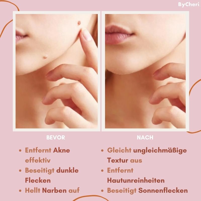 Säg adjö till hudimperfektioner med Flawless Fade | ribuella