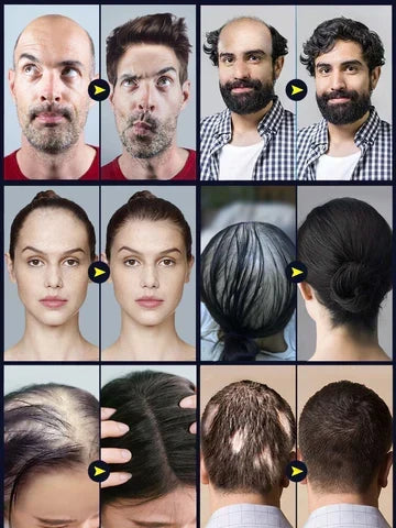 Huile pour cheveux et cuir chevelu - Nourrit le cuir chevelu et les racines - Donne une sensation de cheveux plus épais | ribuella