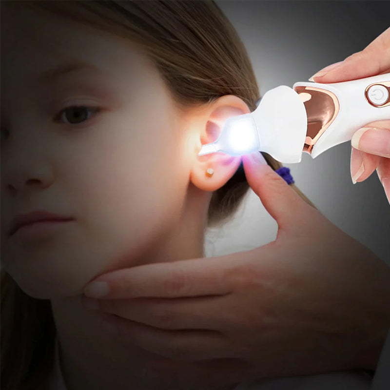 Rimuovi cerume con punta in silicone - Detergente delicato per le orecchie - Ricaricabile tramite USB | ribuella