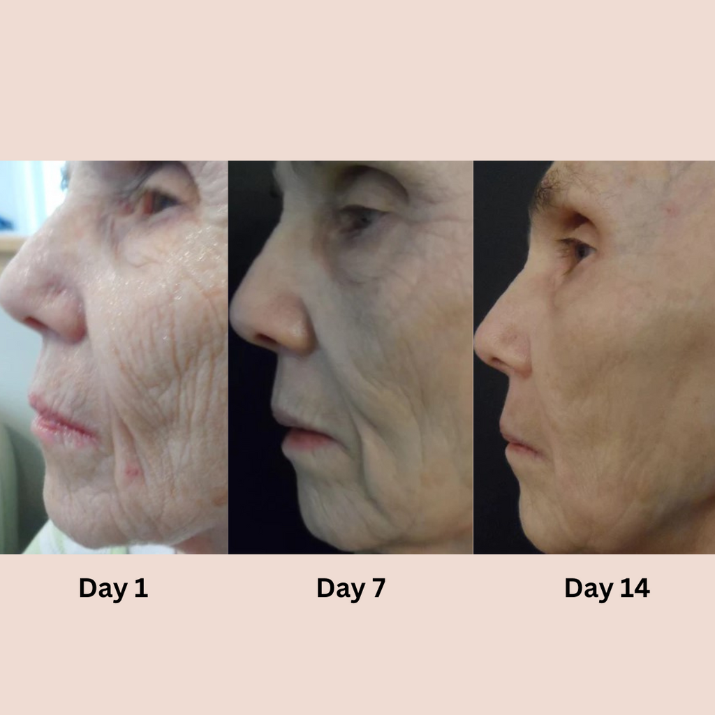 Revitalize Your Eyes for a Youthful Appearance! | ribuella
