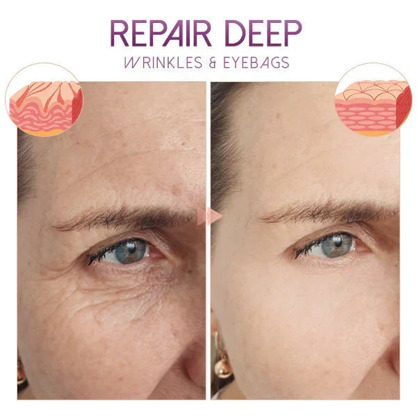 Revitalize Your Eyes for a Youthful Appearance! | ribuella