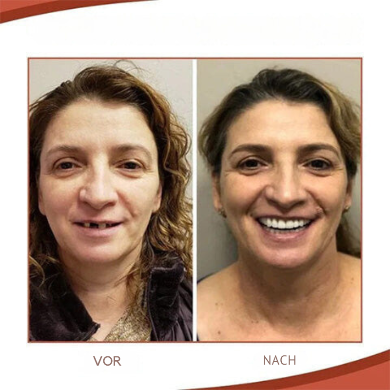 Dentiers sur mesure Dentecare — sourire naturel et sûr