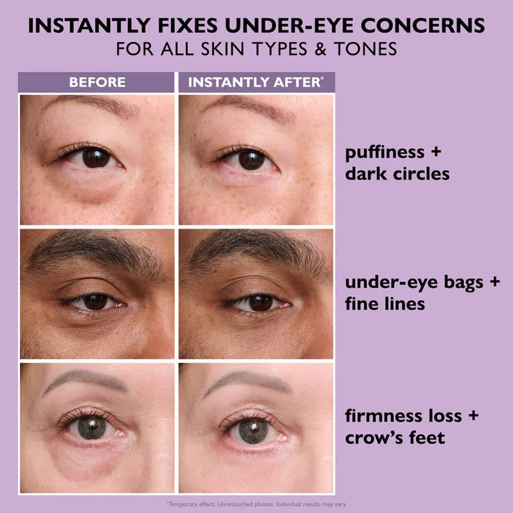 Revitalizing Eye Tightener - Instant Lifting Effect - Smooths Eye Area | ribuella