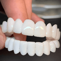 Zubní grillz v retro stylu pro výrazný úsměv | ribuella