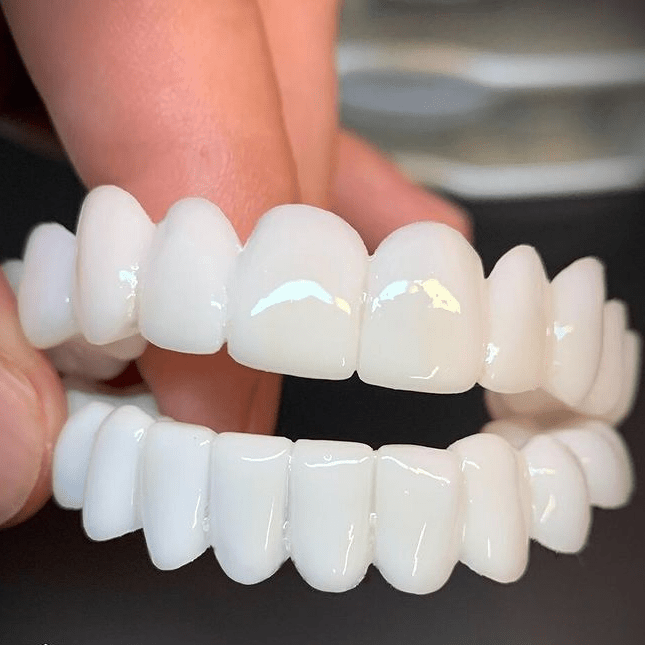 Zubní grillz v retro stylu pro výrazný úsměv | ribuella