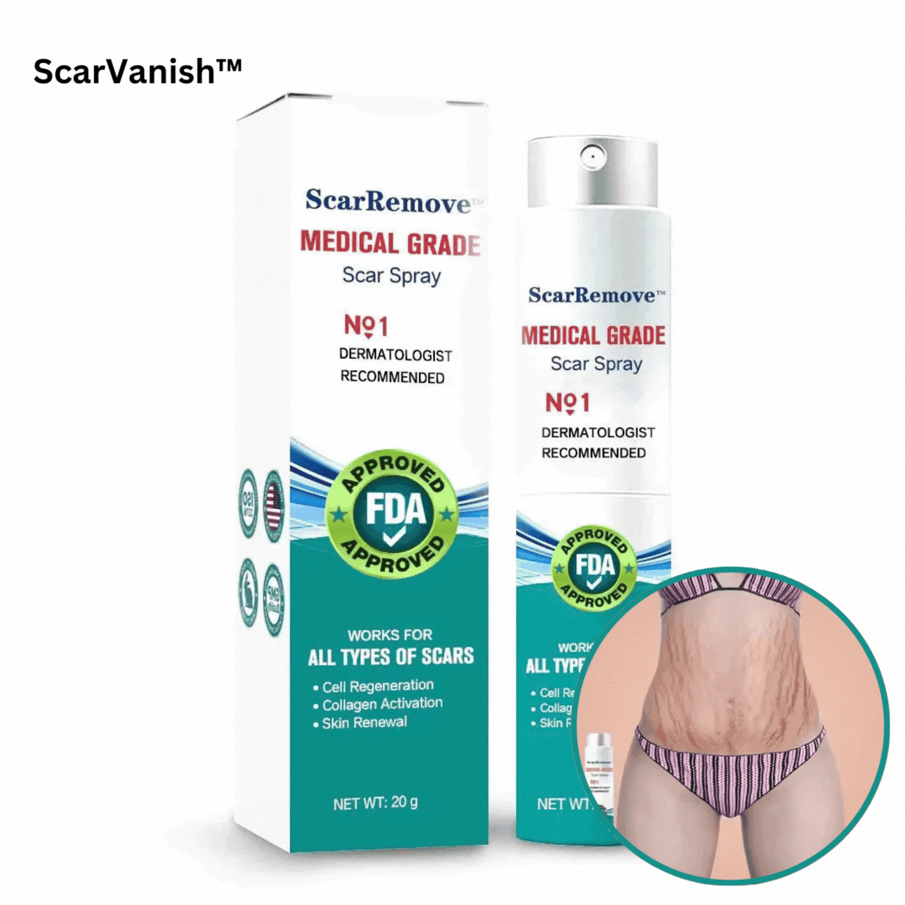 ScarDiminish 100 Advanced Scar Remedy Spray | Watch Scars Disappear and Confidence Skyrocket in Weeks | ribuella