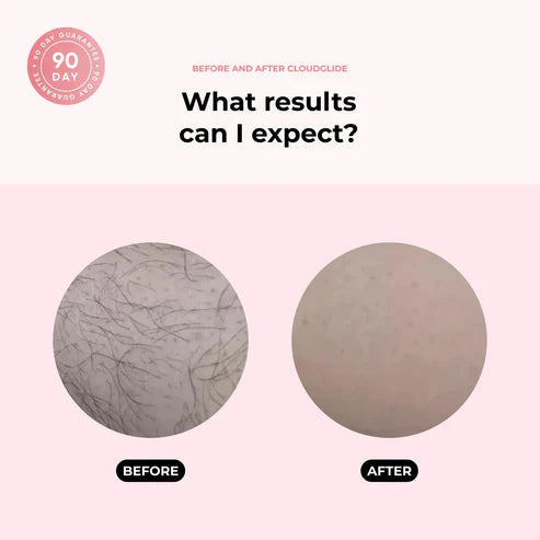 Silk Smooth Skin Anytime, Anywhere | ribuella