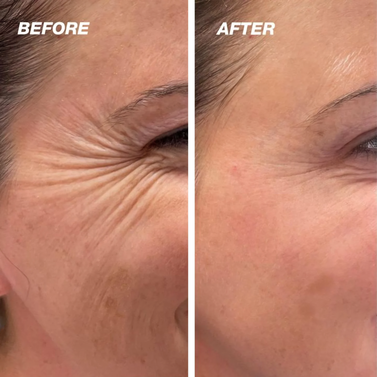 Silicone Scar Sheets for Skin Repair | ribuella