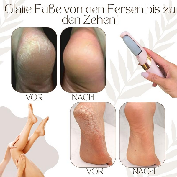 Show Off Your Soft Feet with VelvetStep Foot Care | ribuella
