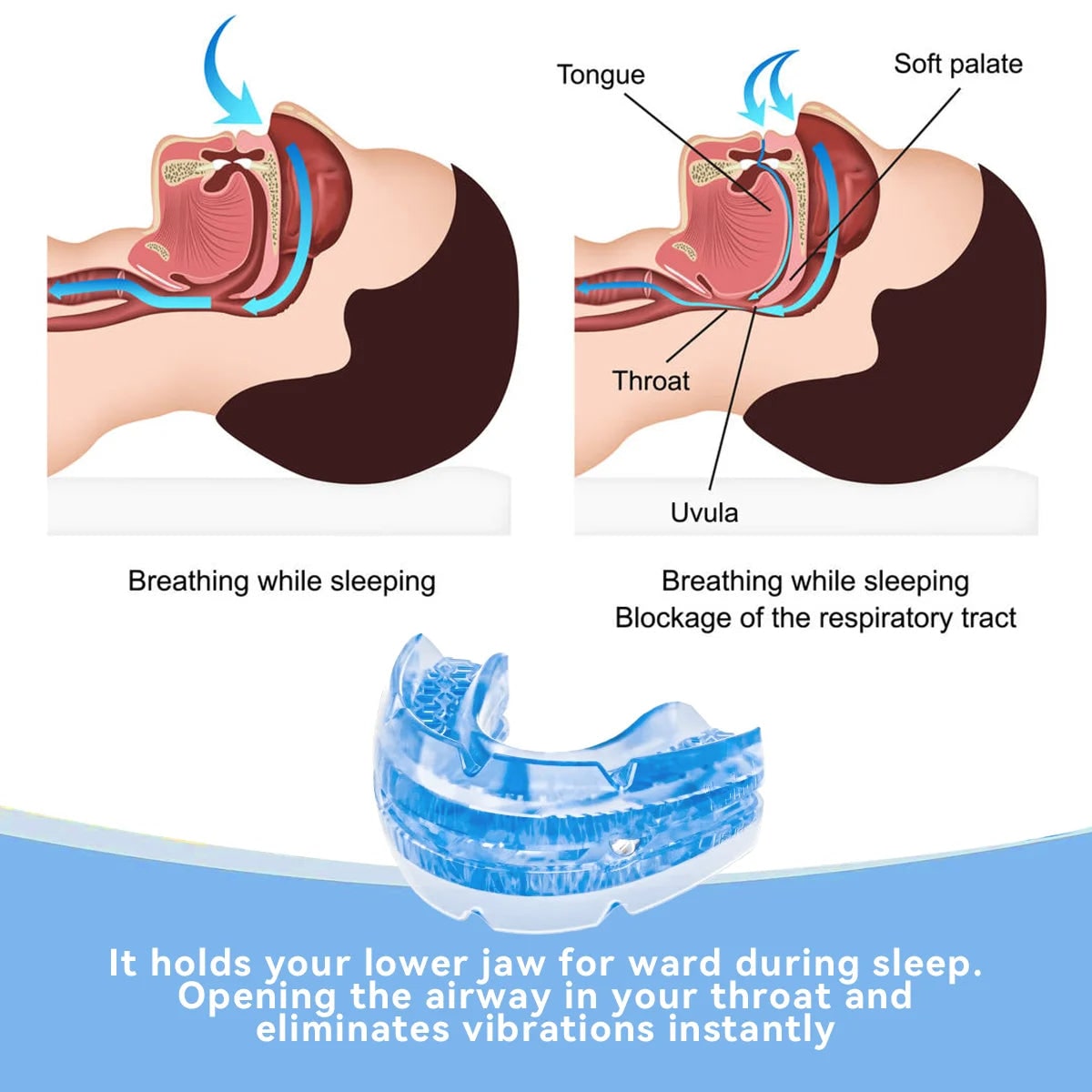 Adjustable Anti Snoring Mouthpiece — Screwdriver And Storage Case Included