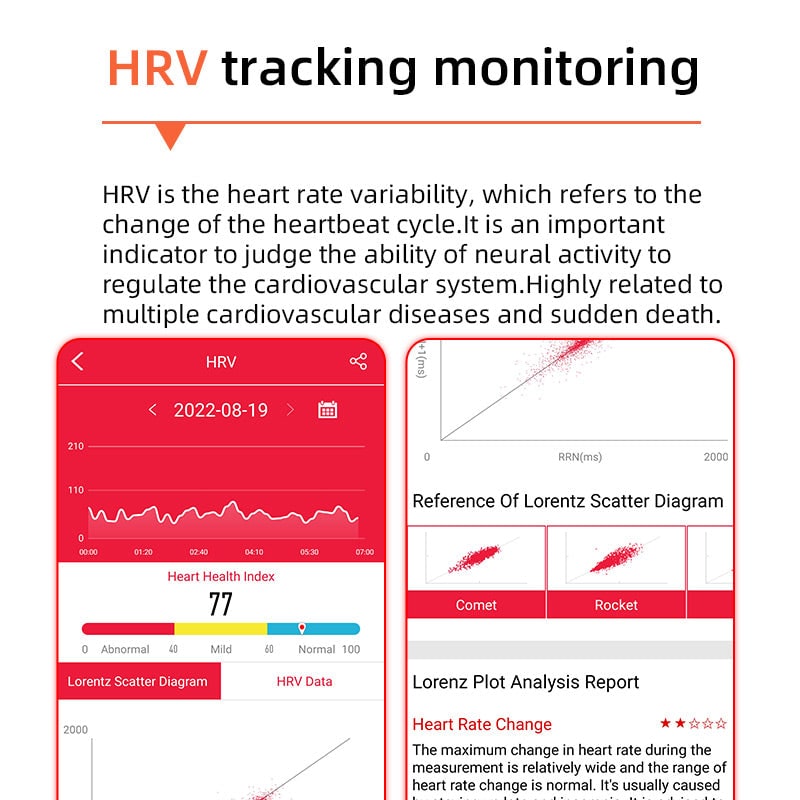 Smartwatch con quadrante rotondo, misurazione della pressione sanguigna, ECG, frequenza cardiaca e monitoraggio della salute, regolabile