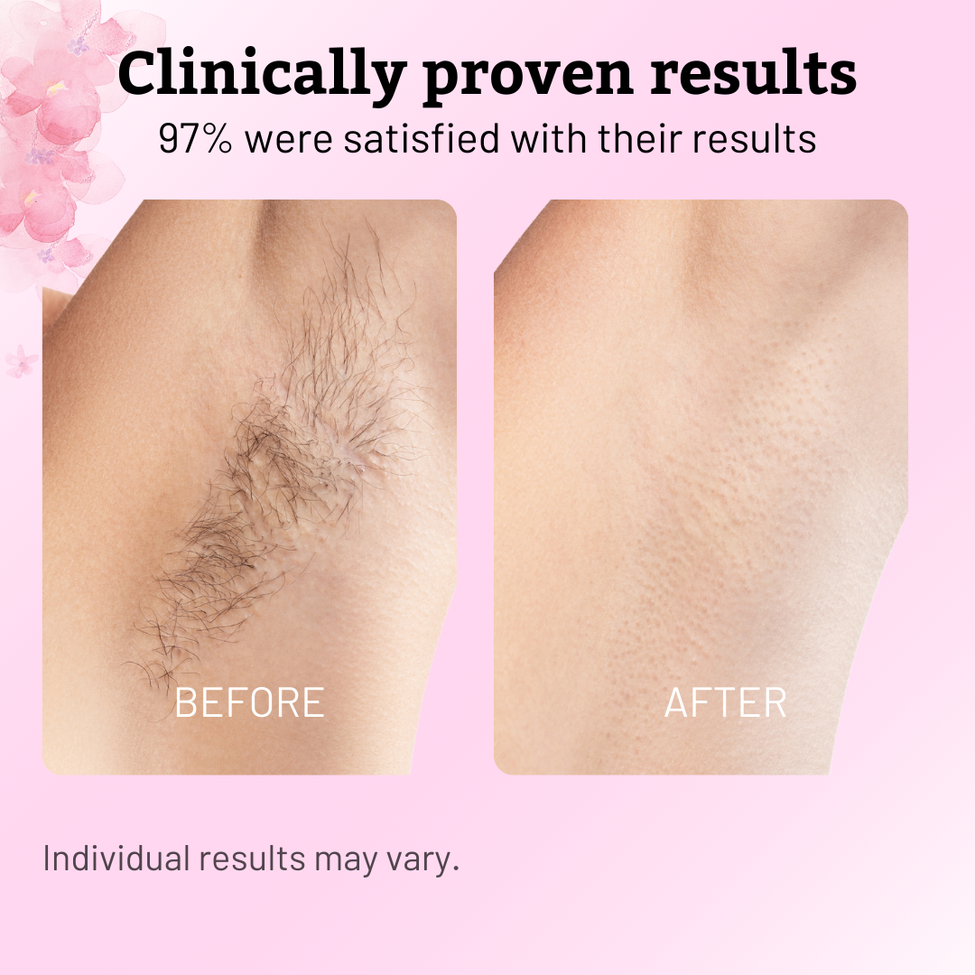 SilkaPure | Experience Pain-Free Softness and Watch Hair Retreat in Just One Week | ribuella