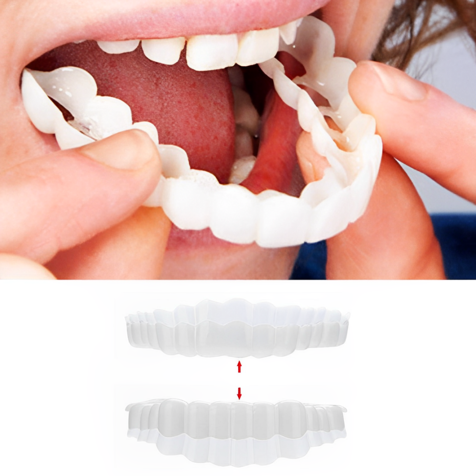 Temporary Snap On Dental Veneers - Upper Lower Cosmetic Tooth Cover Set