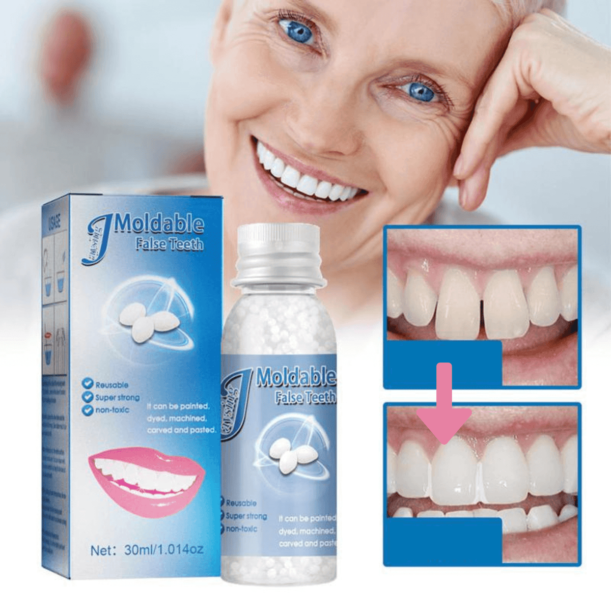 Temporary Tooth Filling Beads — Discreet Emergency Dental Repair