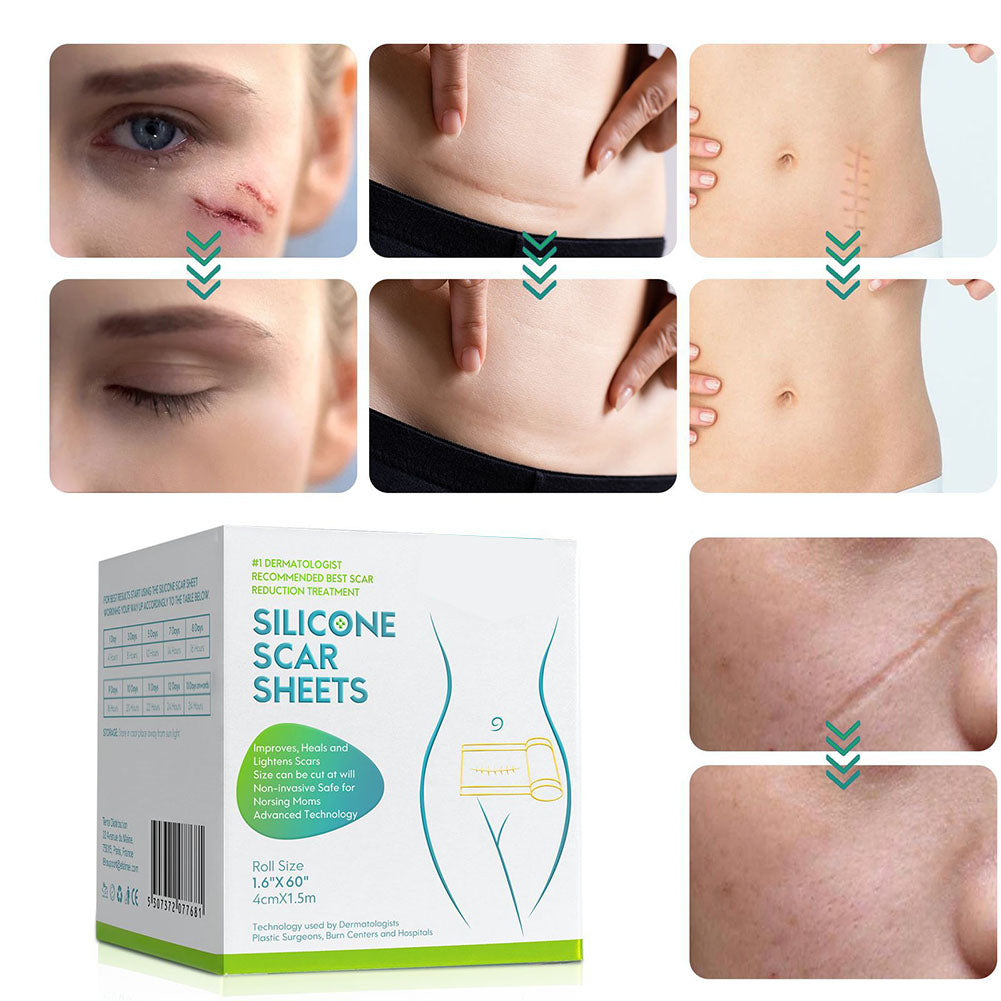 Silicone Scar Tape Roll — Nearly Invisible Skin-Smoothing Sheets